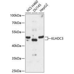 KLHDC3 Rabbit pAb