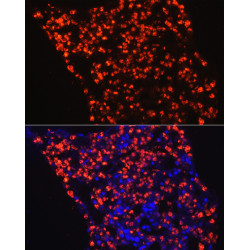 Myeloperoxidase (MPO) Rabbit pAb
