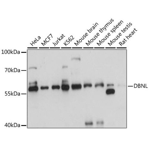 DBNL Rabbit pAb