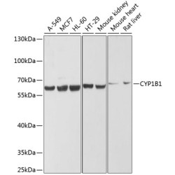 CYP1B1 Rabbit pAb
