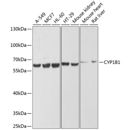 CYP1B1 Rabbit pAb