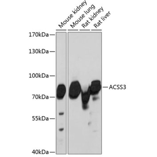 ACSS3 Rabbit pAb