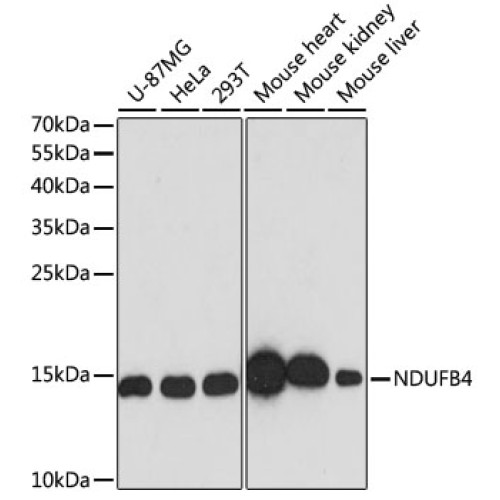 [KO Validated] NDUFB4 Rabbit pAb
