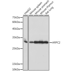 ARPC2 Rabbit mAb