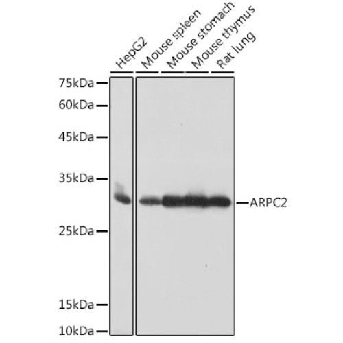 ARPC2 Rabbit mAb