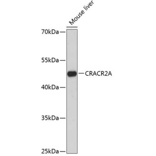 CRACR2A Rabbit pAb