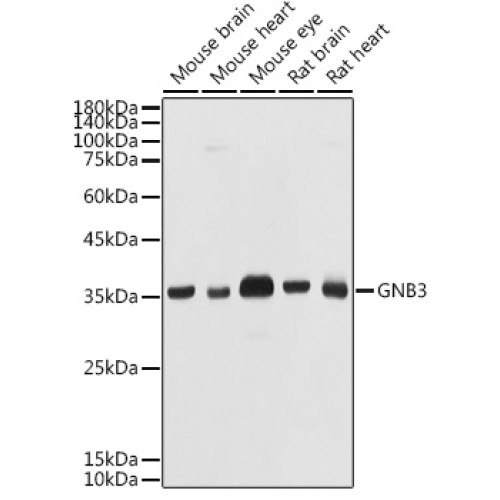 GNB3 Rabbit pAb