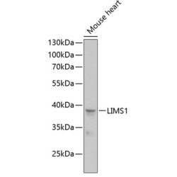 LIMS1 Rabbit pAb