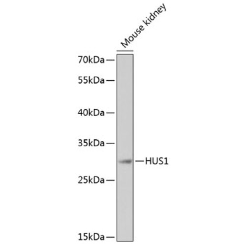 HUS1 Rabbit pAb