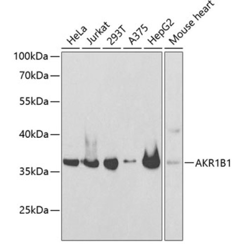 AKR1B1 Rabbit pAb