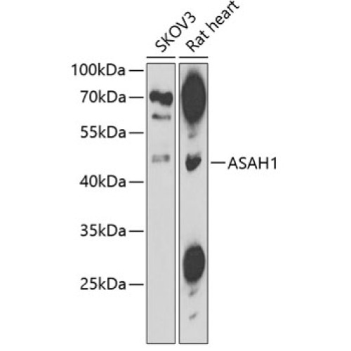 ASAH1 Rabbit pAb