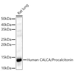 CALCA Rabbit pAb