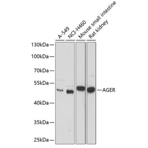 AGER Rabbit pAb