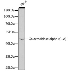 Galactosidase alpha (GLA) Rabbit pAb
