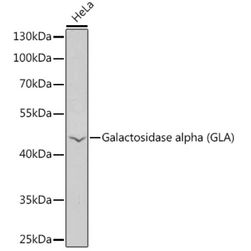 Galactosidase alpha (GLA) Rabbit pAb