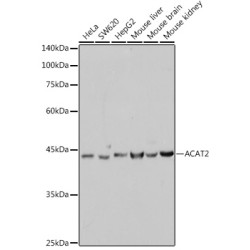 ACAT2 Rabbit mAb