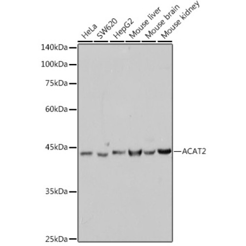 ACAT2 Rabbit mAb