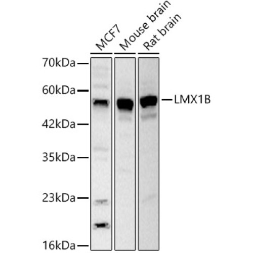 LMX1B Rabbit pAb