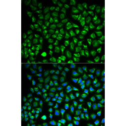 Monoamine Oxidase A (MAOA) Rabbit pAb