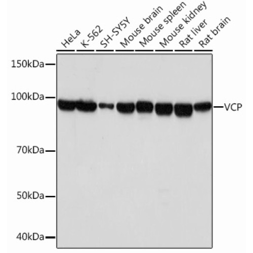 VCP Rabbit mAb