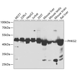 PHKG2 Rabbit pAb