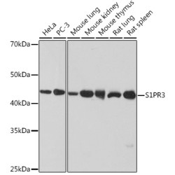 S1PR3 Rabbit mAb