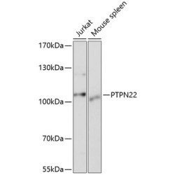 PTPN22 Rabbit pAb
