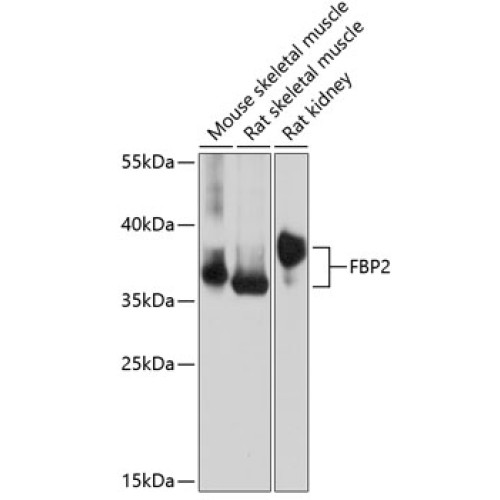 FBP2 Rabbit pAb