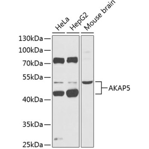 AKAP5 Rabbit pAb