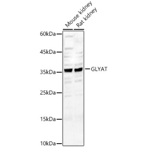 GLYAT Rabbit pAb