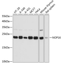 NOP16 Rabbit pAb