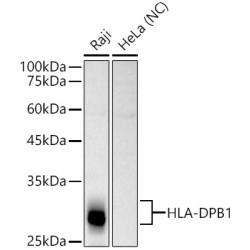 HLA-DPB1 Rabbit pAb