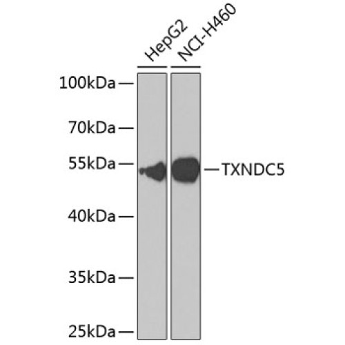 TXNDC5 Rabbit pAb