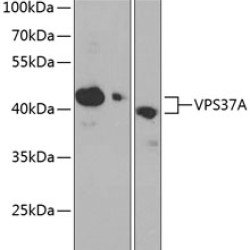 VPS37A Rabbit pAb
