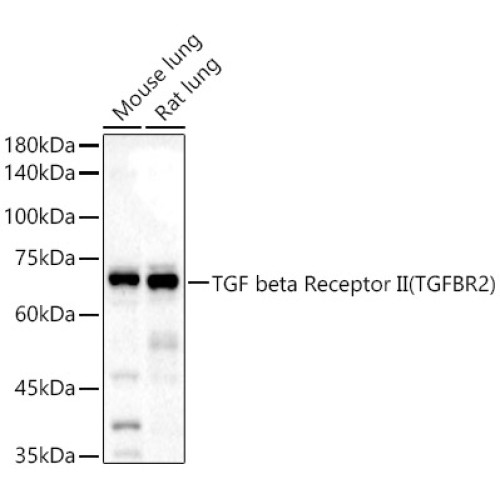 TGF beta Receptor II Rabbit pAb