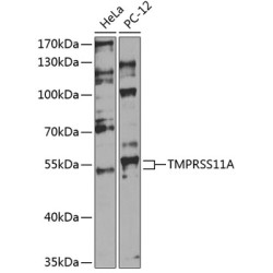 TMPRSS11A Rabbit pAb
