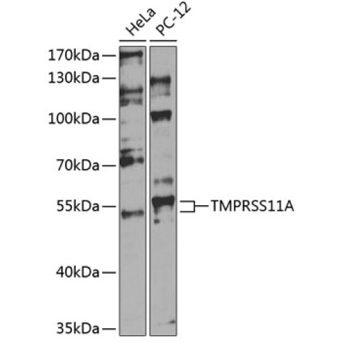 TMPRSS11A Rabbit pAb