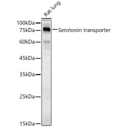 Serotonin transporter Rabbit pAb