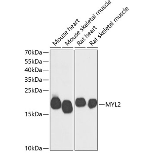 MYL2 Rabbit pAb