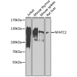 NFATC2 Rabbit pAb