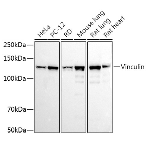 Vinculin Rabbit pAb