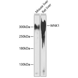 WNK1 Rabbit pAb
