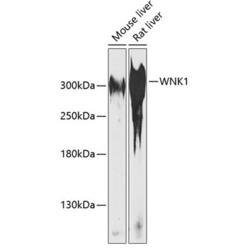 WNK1 Rabbit pAb