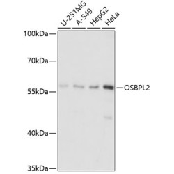 OSBPL2 Rabbit pAb