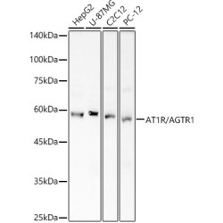 AT1R/AGTR1 Rabbit pAb
