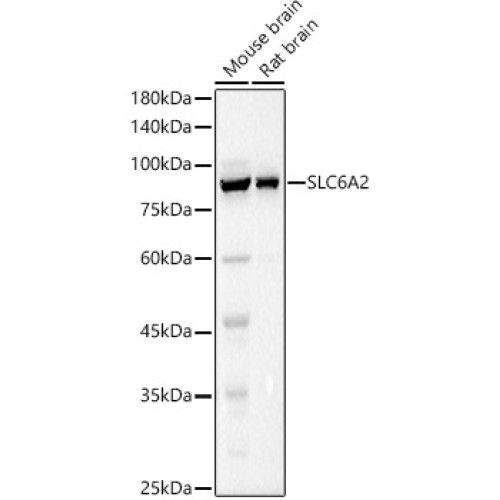 SLC6A2 Rabbit pAb