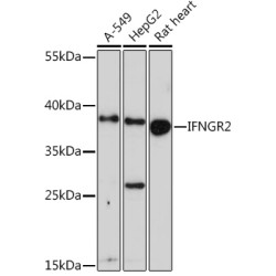 IFNGR2 Rabbit pAb