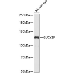 GUCY2F Rabbit pAb