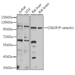 CD62P/P-selectin Rabbit pAb