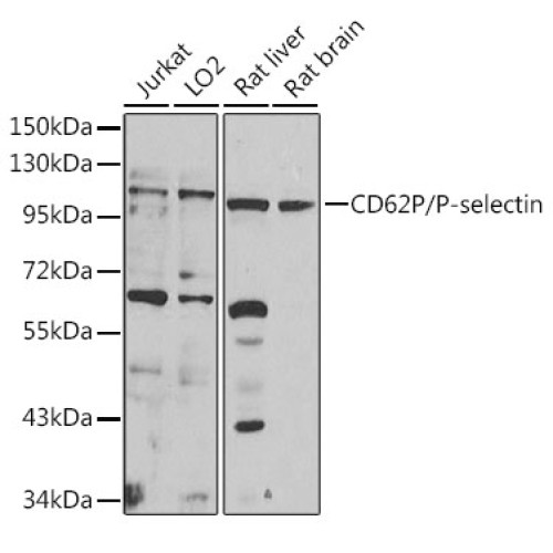 CD62P/P-selectin Rabbit pAb